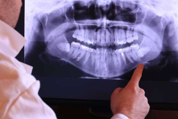 Best Emergency TMJ Treatment in Mcminnville, TN