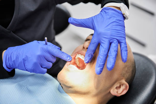 Best Emergency Gum Treatment in Mcminnville, TN